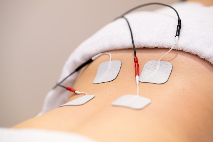 What is Sacral Nerve Stimulation?